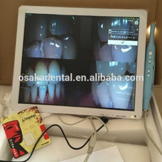 Moniteur blanc 17 pouces + caméra intra-orale dentaire avec support de moniteur VGA + VIDEO + US B +