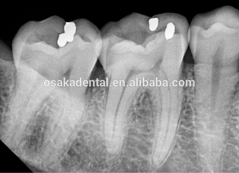 Mur dentaire monté avec la machine à rayons X approuvée CE