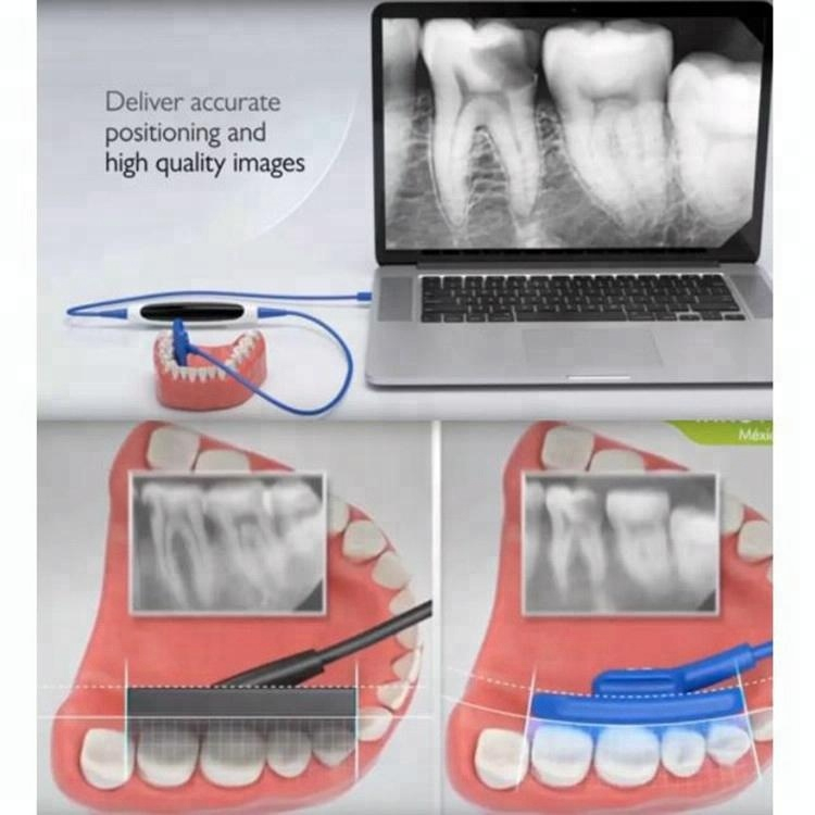 Un nouveau capteur dentaire à rayons X doux numérique coréen EZ
