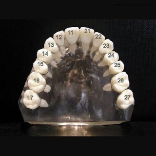 Dents dentaires avec vis pour étude Molde OSA-Teeth-N