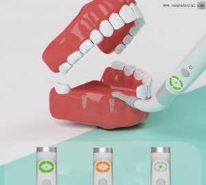 Localisateur d'implant dentaire, détecteur d'implant pour localiser les vis d'implant