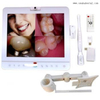 Système de caméra intra-orale sans fil de moniteur dentaire blanc de 15 pouces