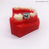 Couronne pour enfants en acier inoxydable orthodontique dentaire OSA-P30