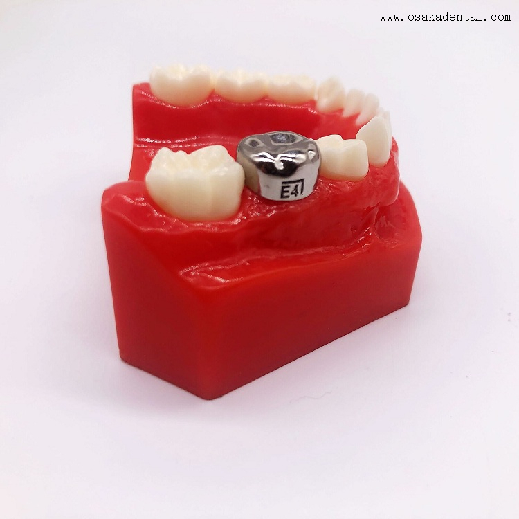 Couronne pour enfants en acier inoxydable orthodontique dentaire OSA-P30