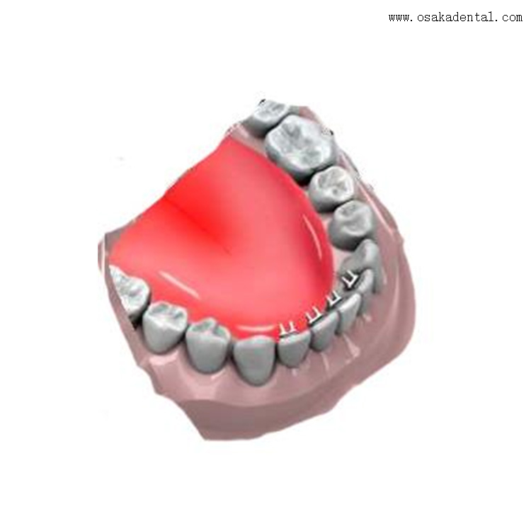 Accessoires orthodontiques dentaires Mini éducateur de l'éperon lingual