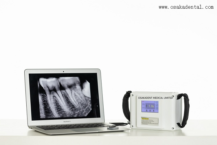 Unité de radiographie portable dentaire de bonne qualité OSA-F058E