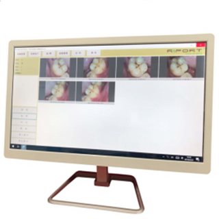 Systété d'ordinateur avec caméra intra-orale dentaire à écran tactile et moniteur pour chaise dentaire