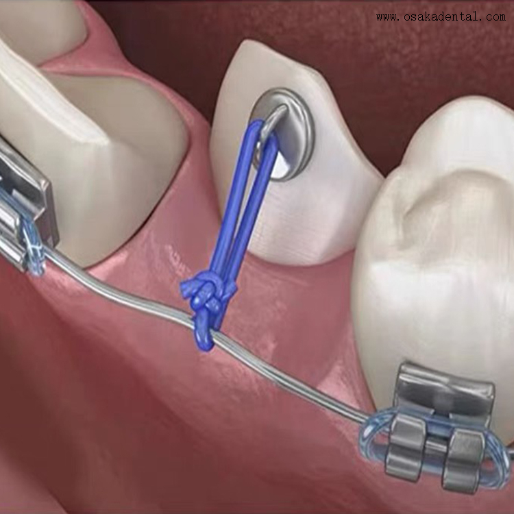 Fil de puissance orthodontique dentaire d'accessoires orthodontiques dentaires de 25 pieds 