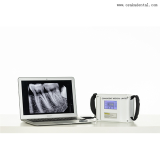 Équipement dentaire Unité de rayons X portable dentaire