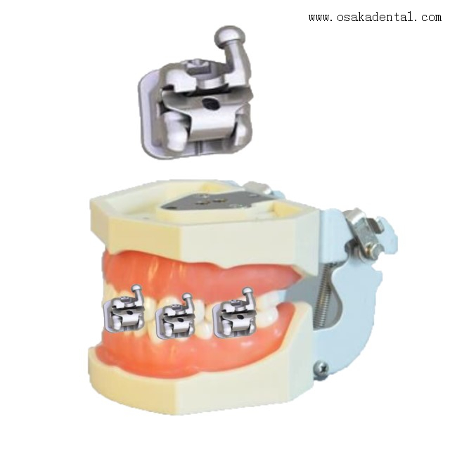 Support orthodontique dentaire Support autobloquant Support dentaire auto-ligaturant (meilleure qualité)