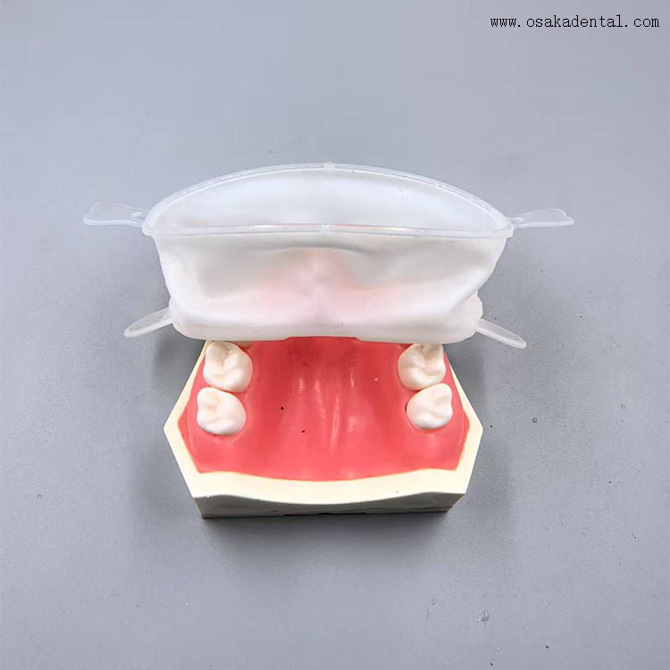 Ouvre-bouche complet de haute qualité, consommable dentaire