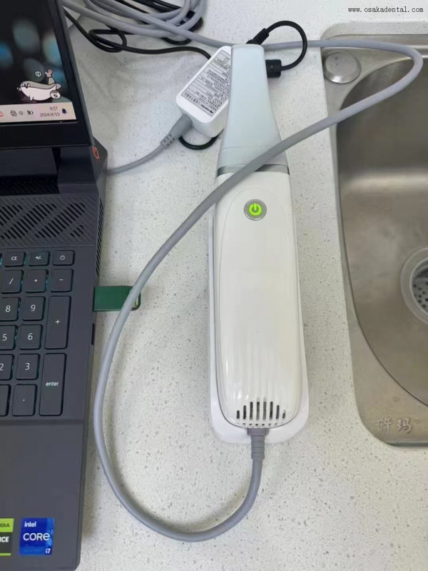 Scanner oral 3D de haute technologie pour une analyse dentaire précise