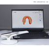 Scanner intra-oral dentaire modèle 3D