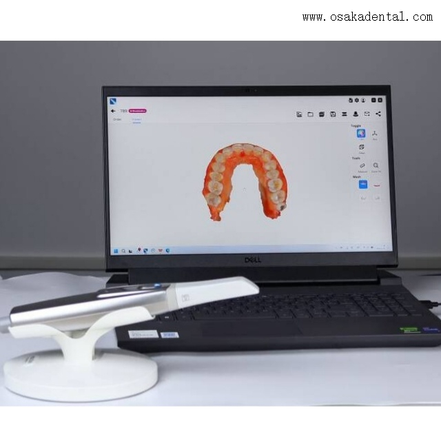Scanner intra-oral dentaire modèle 3D