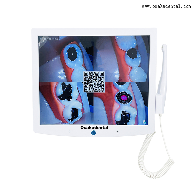 Moniteur de fauteuil dentaire avec caméra orale