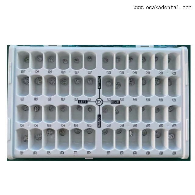 Ensemble complet de couronne dentaire en métal pour enfants