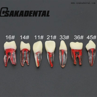 Étude dentaire sur les dents du canal radiculaire Molde