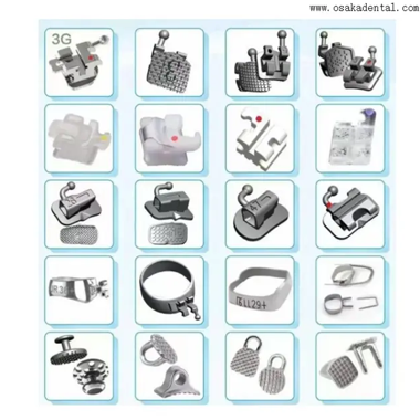 Tout ce que vous devez savoir sur le traitement orthodontique et son fonctionnement