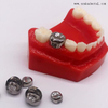 Kid Metal Crown Accessoires orthodontiques dentaires pour enfants