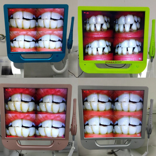 Moniteur coloré de 17 pouces + caméra intra-orale dentaire Wifi avec support de moniteur VGA + VIDEO + US B +